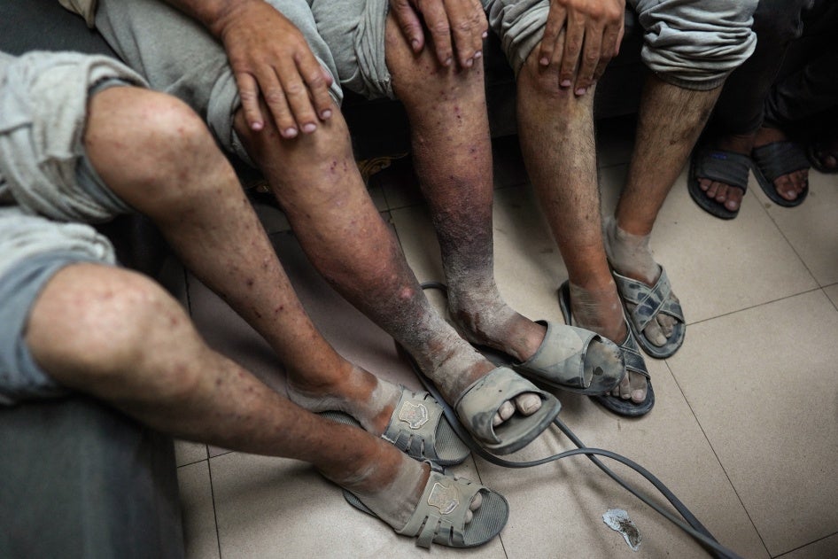 Palestinian men who had been detained by Israeli forces arrive after their release for a checkup at the Al-Aqsa Martyrs Hospital in Deir el-Balah in the central Gaza Strip, July 1, 2024.